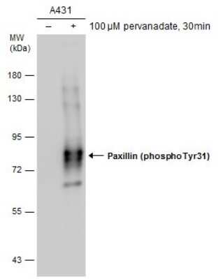 <b>Biological Strategies Validation and Genetic Strategies Validation.</b>Western Blot: Paxillin [p Tyr31] Antibody [NBP3-13074] - Untreated (-) and treated (+) A431 whole cell extracts (5 ug) were separated by 7.5% SDS-PAGE, and the membrane was blotted with Paxillin (phospho Tyr31) antibody (NBP3-13074) diluted at 1:1000.